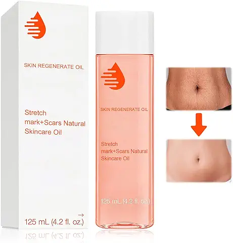 Aceite Antiestrias Embarazo, Aceite Corporal Hidratante, Crema Antiestrias Embarazo, Estrias Eliminar Mejora la Piel Seca y el Tono de la Piel, 125ml  