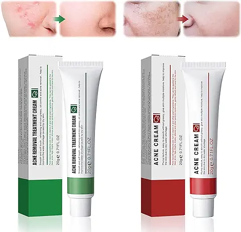 Crema Antimanchas Facial Mujer y Hombres,Crema Antiacne 20g+ Crema Quita Manchas Granos Cara 20g,Aclarador de Manchas Faciales, Antiacné, Facial para Hombres y Mujeres  