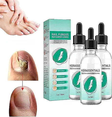 Kerassentials Aceite de Tratamiento de Hongos en las Uñas de los Pies, Kerassentials para Hongos en las Uñas de los Pies, Tratamiento de Uñas Kerasentials, kit de Reparación de Uñas para Uñas  